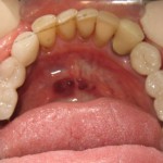 Sage Dental Pocatello Idaho After Dental Work