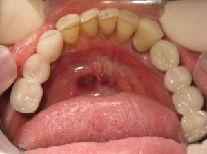 Sage Dental Pocatello Idaho After Dental Work
