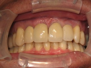 Sage Dental Pocatello Idaho after dental work