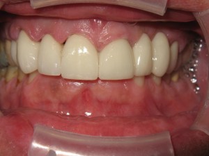 Sage Dental Pocatello Idaho after dental work