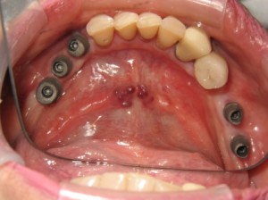 Sage Dental Pocatello Idaho before dental work
