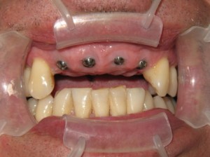 Sage Dental Pocatello Idaho Before Work