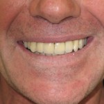 Sage Dental Pocatello Idaho Dental Implants